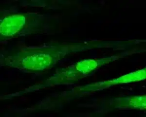 Cell Transfection